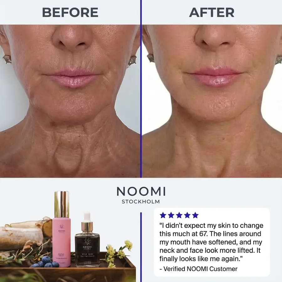 NOOMI Stockholm skincare ad — before and after of a lifted jawline with a five-star customer review